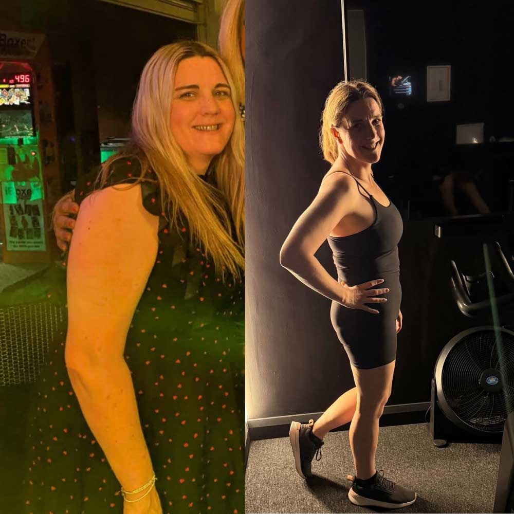 Kym — one year transformation